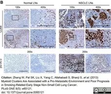 Anti Human CD68 Antibody, clone 514H12 gallery image 6