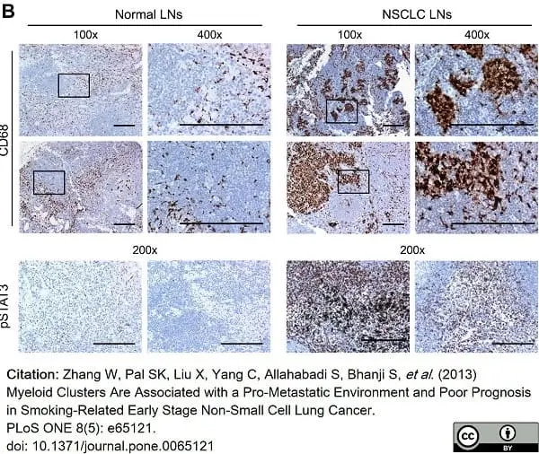 Anti Human CD68 Antibody, clone 514H12 gallery image 6