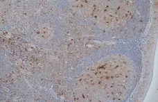Anti Human CD68 Antibody, clone KP1 gallery image 2