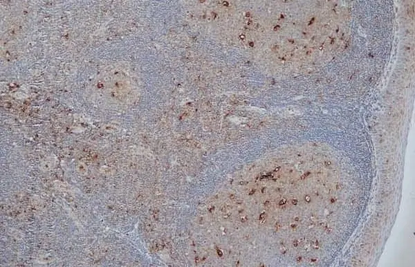 Anti Human CD68 Antibody, clone KP1 gallery image 2