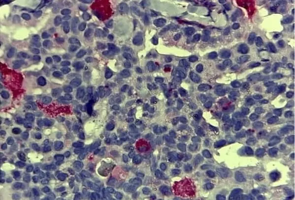 Anti Human CD68 Antibody, clone KP1 gallery image 3