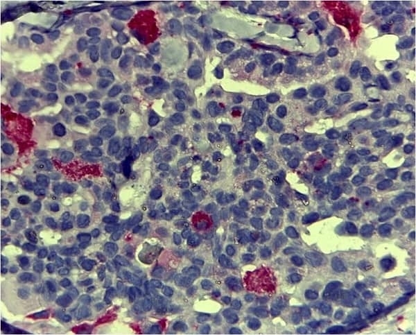 Anti Human CD68 Antibody, clone KP1 gallery image 3