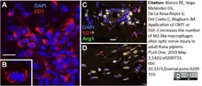Anti Human CD68 Antibody, clone KP1 gallery image 4