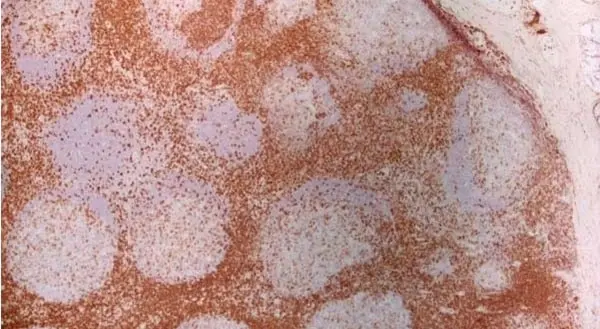 Anti Human CD7 Antibody, clone LT7 gallery image 3