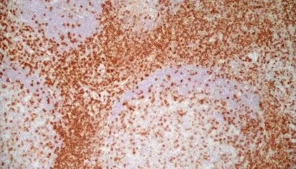 Anti Human CD7 Antibody, clone LT7 gallery image 4