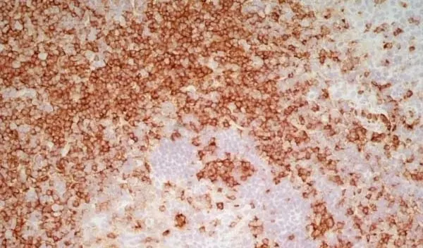 Anti Human CD7 Antibody, clone LT7 gallery image 5