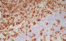 Anti Human CD7 Antibody, clone LT7 gallery image 6