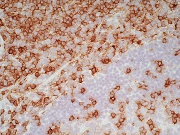 Anti Human CD7 Antibody, clone LT7 gallery image 6