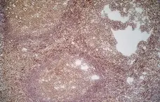 Anti Human CD70 Antibody, clone Bu69 gallery image 1