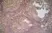 Anti Human CD70 Antibody, clone Bu69 thumbnail image 1