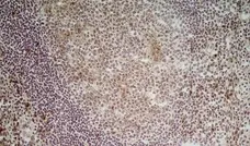 Anti Human CD70 Antibody, clone Bu69 gallery image 2