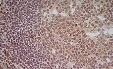 Anti Human CD70 Antibody, clone Bu69 gallery image 3