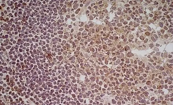 Anti Human CD70 Antibody, clone Bu69 gallery image 3