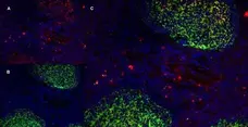 Anti Human CD70 Antibody, clone Bu69 gallery image 4