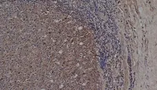 Anti Human CD72 Antibody, clone Bu40 gallery image 1