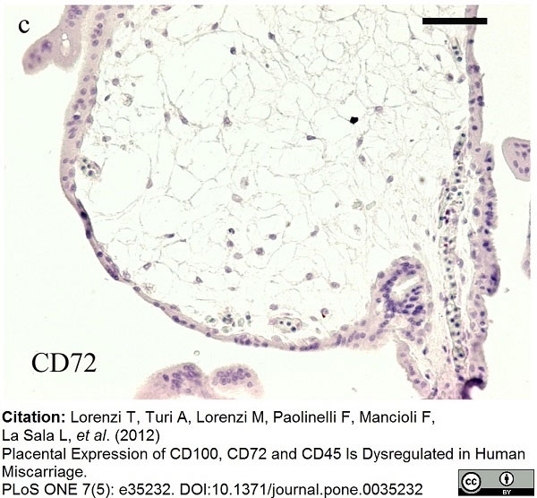 Anti Human CD72 Antibody, clone Bu40 gallery image 5