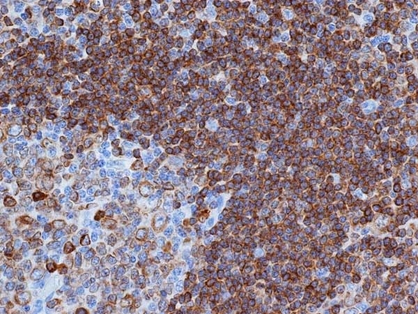 Anti Human CD79a Antibody, clone HM57 thumbnail image 2