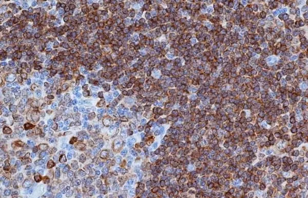 Anti Human CD79a Antibody, clone HM57 gallery image 2