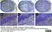 Anti Human CD79a Antibody, clone HM57 thumbnail image 3