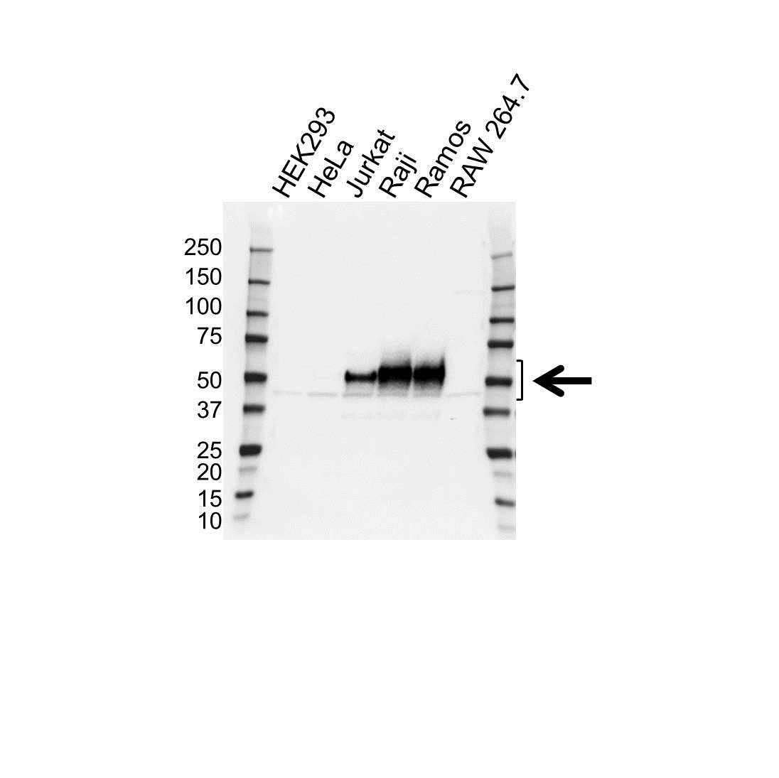 Anti CD79a Antibody (PrecisionAb Monoclonal Antibody) gallery image 1