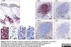 Anti Human CD8 Antibody, clone 4B11 gallery image 2