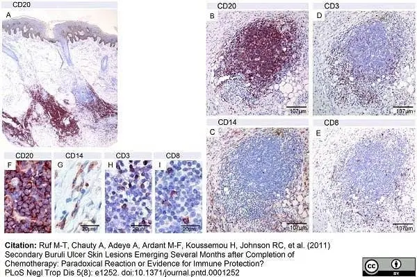 Anti Human CD8 Antibody, clone 4B11 gallery image 2