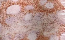Anti Human CD8 Antibody, clone LT8 gallery image 1
