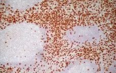 Anti Human CD8 Antibody, clone LT8 gallery image 2