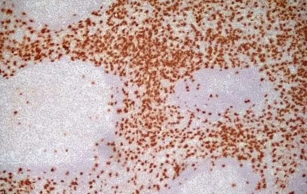 Anti Human CD8 Antibody, clone LT8 gallery image 2