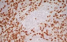 Anti Human CD8 Antibody, clone LT8 gallery image 3