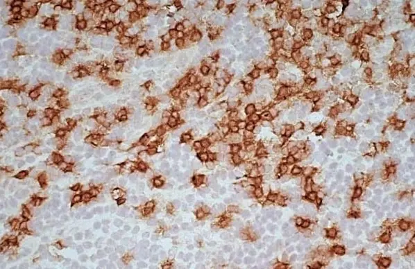Anti Human CD8 Antibody, clone LT8 gallery image 4