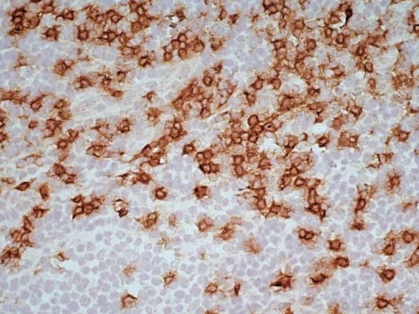 Anti Human CD8 Antibody, clone LT8 gallery image 8