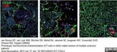 Anti Human CD8 Antibody, clone YTC182.20 gallery image 10