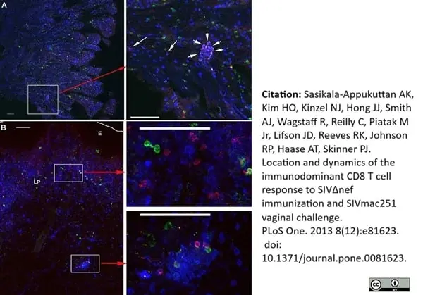 Anti Human CD8 Antibody, clone YTC182.20 gallery image 13