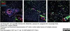 Anti Human CD8 Antibody, clone YTC182.20 gallery image 7