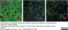 Anti Human CD8 Antibody, clone YTC182.20 gallery image 8