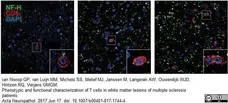 Anti Human CD8 Antibody, clone YTC182.20 gallery image 9