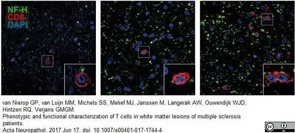 Anti Human CD8 Antibody, clone YTC182.20 gallery image 9