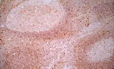 Anti Human CD83 Antibody, clone HB15e gallery image 4