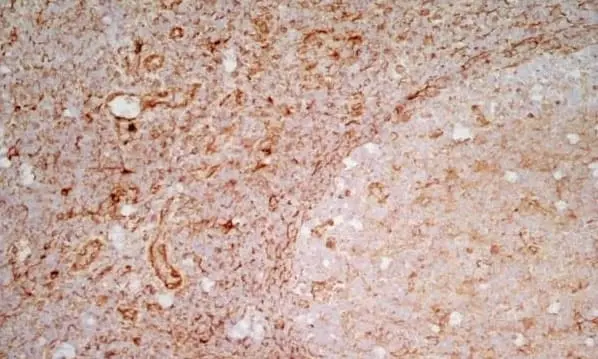 Anti Human CD83 Antibody, clone HB15e gallery image 5