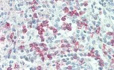 Anti Human CD88 Antibody, clone P12/1 gallery image 4