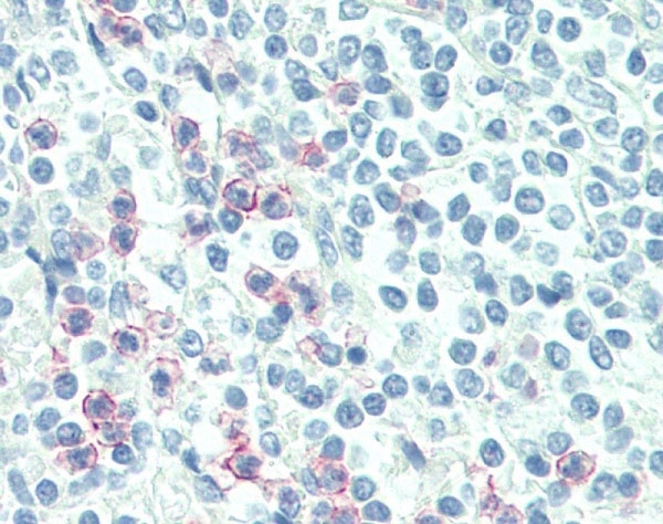 Anti Human CD88 Antibody, clone S5/1 gallery image 4