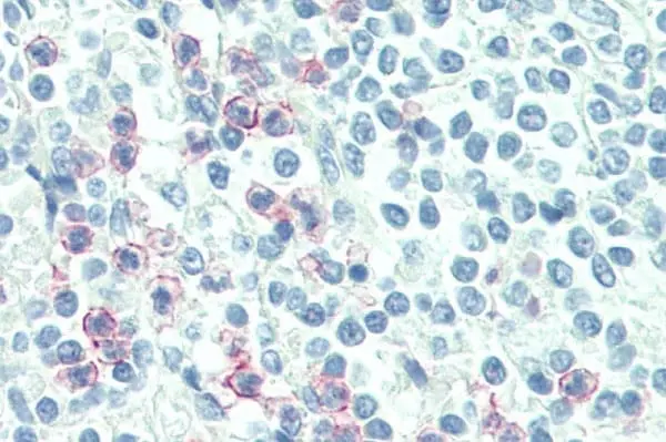 Anti Human CD88 Antibody, clone S5/1 gallery image 4