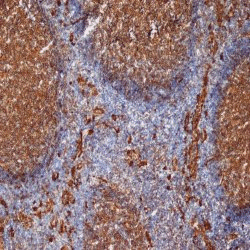 Anti Human CD9 Antibody, clone MM2/57 gallery image 3
