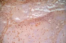 Anti Human CD91 Antibody, clone A2Mr alpha-2 gallery image 2