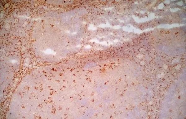 Anti Human CD91 Antibody, clone A2Mr alpha-2 gallery image 2