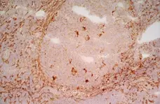 Anti Human CD91 Antibody, clone A2Mr alpha-2 gallery image 3