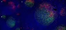 Anti Human CD91 Antibody, clone A2Mr alpha-2 gallery image 5