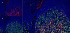 Anti Human CD91 Antibody, clone A2Mr alpha-2 gallery image 6