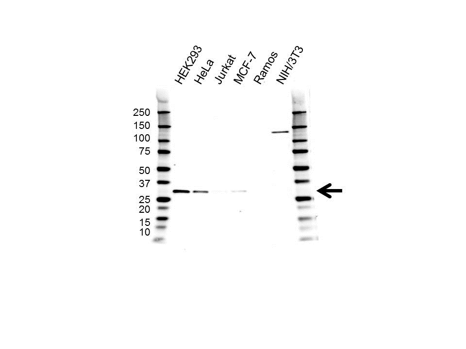 Anti CDK4 Antibody, clone 1529CT850.162.73 (PrecisionAb Monoclonal Antibody) gallery image 1
